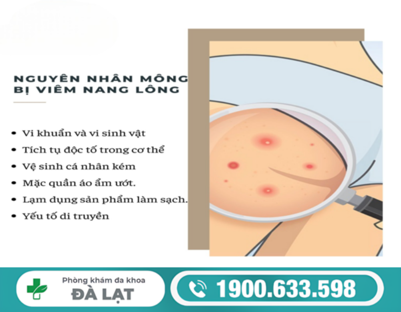 Hình ảnh minh họa